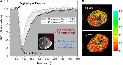 The Role of Muscle Perfusion in the Age-Associated Decline of Mitochondrial Function in Healthy Individuals